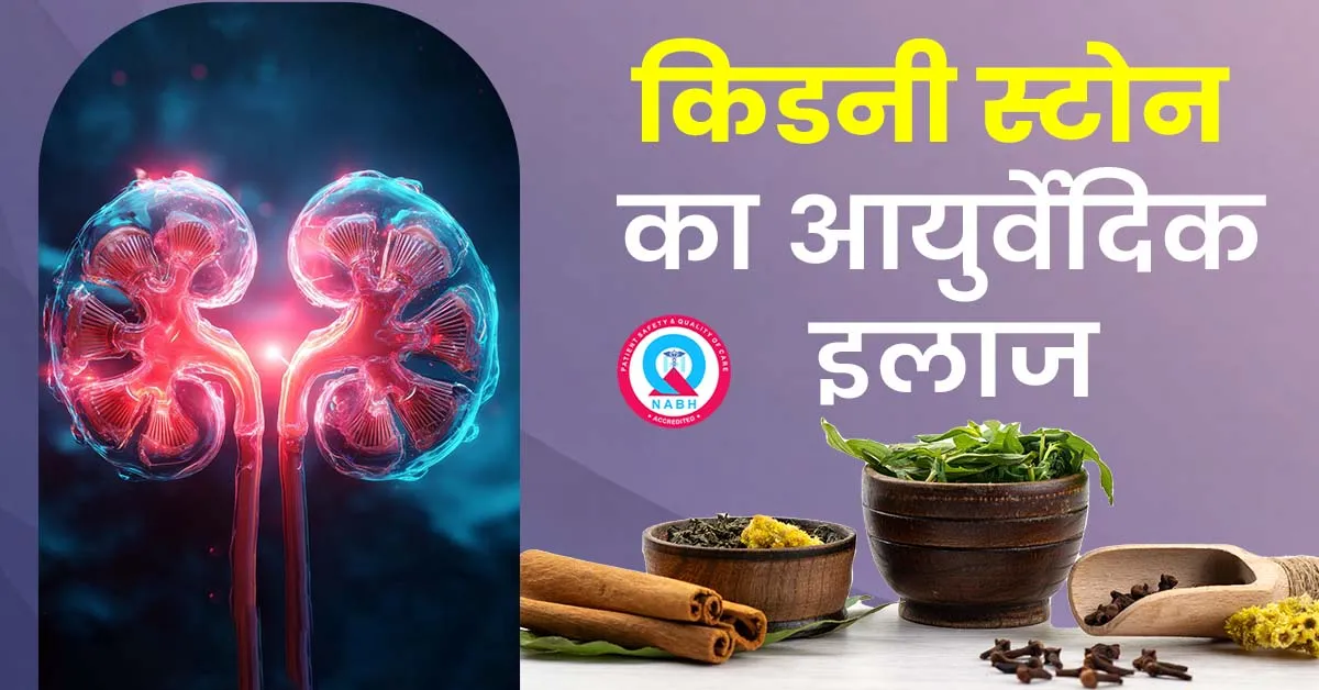 किडनी-स्टोन-का-आयुर्वेदिक-इलाज